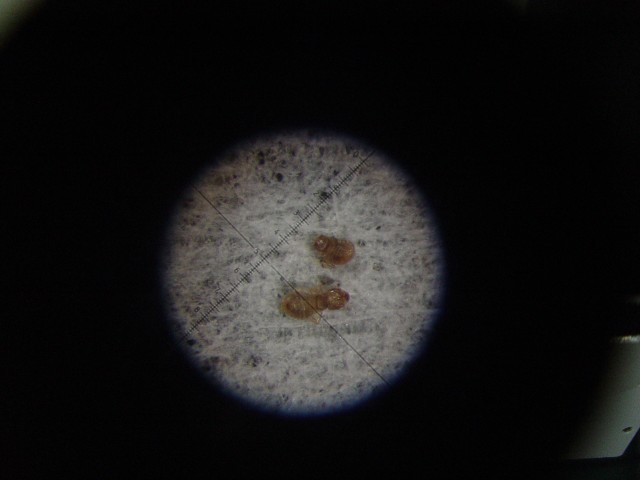 顯微鏡下的囓蟲-1  (體長不到 1 mm)