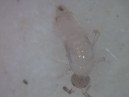 裝潢後常見的小蟲-跳蟲幼蟲（放大200倍）